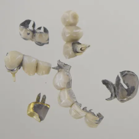 Orensade tänder, 18K Vikt: 29,9 g