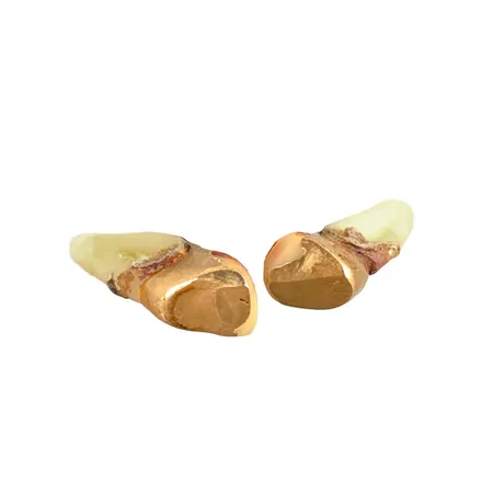 Tandguld, orensat, cirka 18K, bruttovikt Vikt: 6,3 g