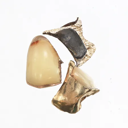 Tandguld, orensat Vikt: 3,5 g