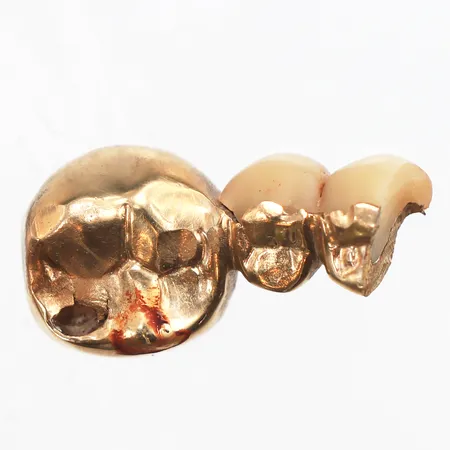 Tandguld, orensat Vikt: 3,6 g