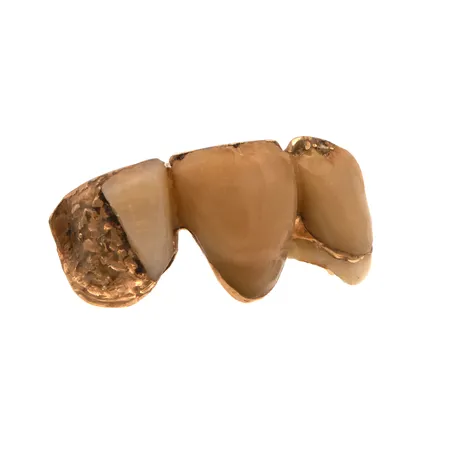 Hammaskultaa, 750br,  Paino: 5,3 g